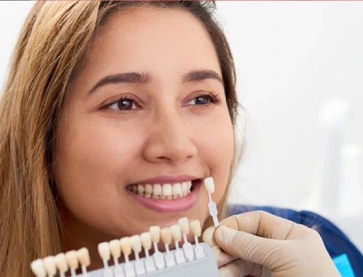 Dental Veneers in Goregaon West Dental Veneers in Goregaon West