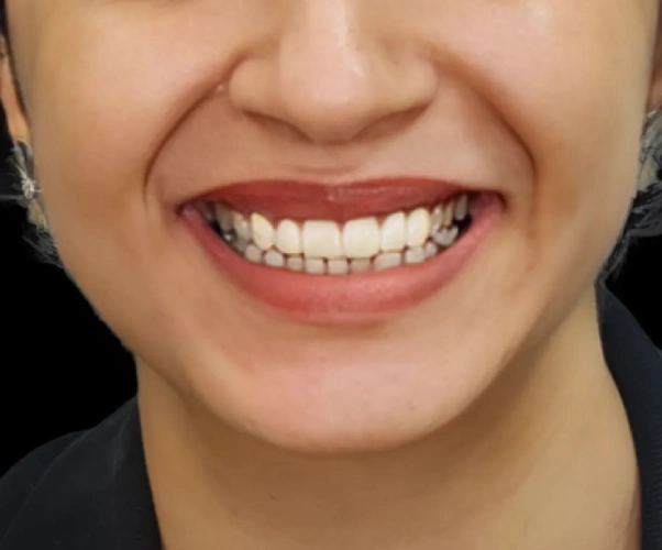 Before